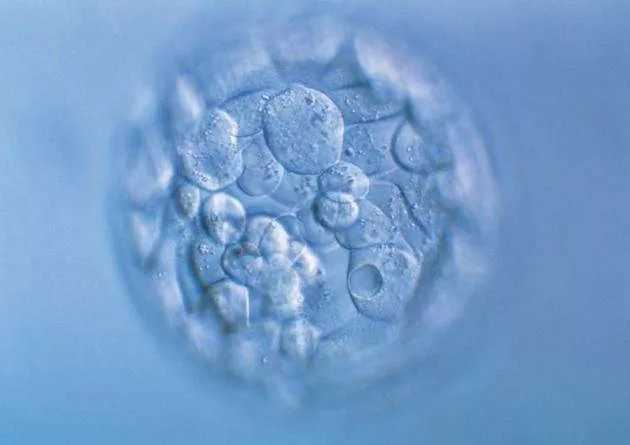 宝宝29周胎位不正