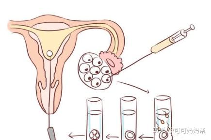 怀孕1-10月检查表