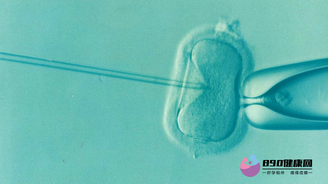 宁波试管婴儿技术